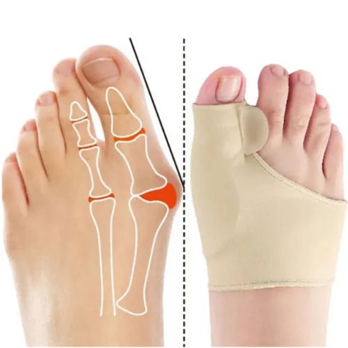 Orthèse souple hallus valgus