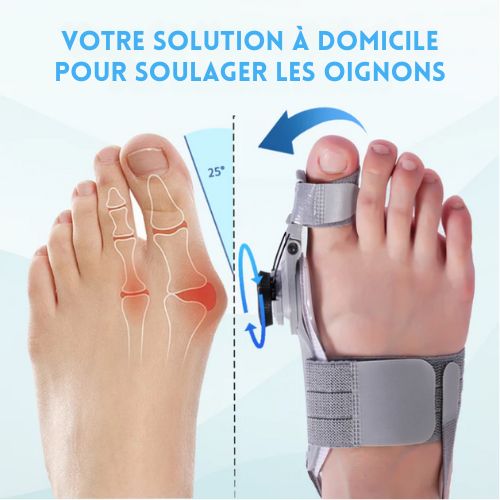 Orthèse hallux valgus