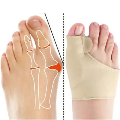 Orthèse souple hallus valgus