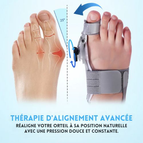 Orthèse hallux valgus